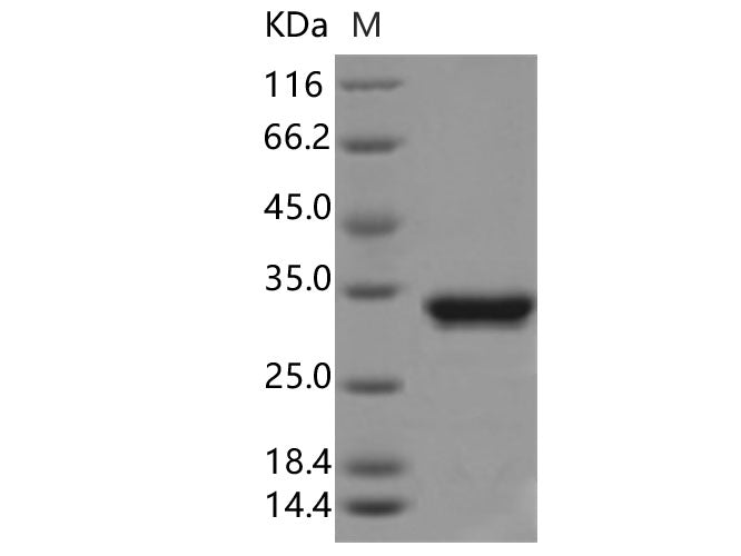 Recombinant Aequorea victoria GFP Protein (His Tag)