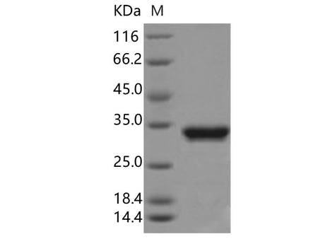 Recombinant Aequorea victoria GFP Protein (His Tag)