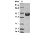 Recombinant CHIKV (strain SL-CK1) Envelope 2 Protein (His Tag)