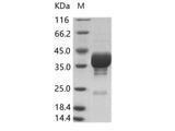 Recombinant Cox A16 (strain G-10) VP4 Protein (Fc Tag)