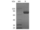 Recombinant Cynomolgus B7-1/CD80 Protein (Fc Tag)