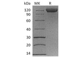 Recombinant Cynomolgus B7-H3/CD276 Protein (Fc Tag)