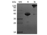 Recombinant Cynomolgus BCMA/TNFRSF17/CD269 Protein (Fc Tag)