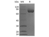 Recombinant Cynomolgus CD38/ADP-ribosyl Cyclase 1 Protein (Fc Tag)