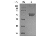 Recombinant Cynomolgus CD38/ADP-ribosyl Cyclase 1 Protein (His Tag)