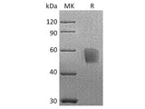 Recombinant Cynomolgus CD3d/CD3 delta Protein (Fc Tag)
