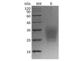 Recombinant Cynomolgus CD3d/CD3 delta Protein (His Tag)