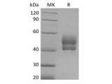Recombinant Cynomolgus CD3D&CD3E Heterodimer (C-Fc-Flag&C-Fc-6His)