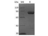 Recombinant Cynomolgus CRTAM/CD355 Protein (Fc Tag)