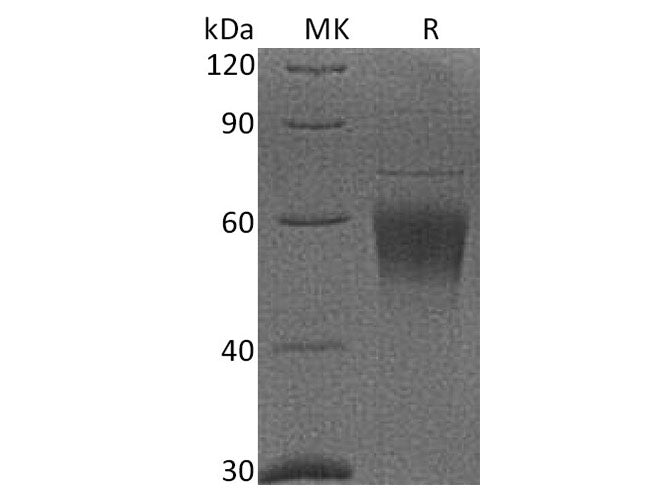 Recombinant Cynomolgus CRTAM/CD355 Protein (His Tag)
