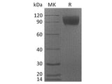 Recombinant Cynomolgus CSF1R/CD115 Protein (His Tag)