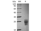 Recombinant Cynomolgus CTLA-4/CD152 Protein (His Tag)