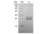 Recombinant Cynomolgus FGF-21/Fibroblast Growth Factor 21 Protein (His Tag)