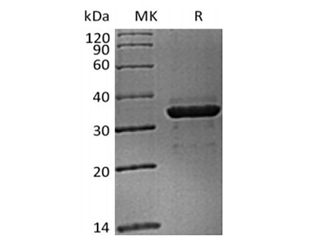 Recombinant Cynomolgus FGL1 (C-6His)