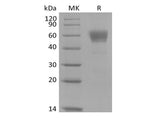 Recombinant Cynomolgus IL-3 Receptor Subunit Alpha/IL-3RA/CD123 (C-Fc)