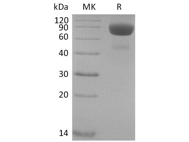 Recombinant Cynomolgus IL-4 Receptor Subunit Alpha/IL-4RA (C-Fc)