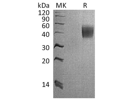 Recombinant Cynomolgus Interleukin-4 Receptor Subunit Alpha/IL-4 Rα Protein (His Tag)