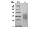 Recombinant Cynomolgus NKG2-D type II Integral Membrane Protein/NKG2D/CD314 (N-6His)