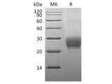 Recombinant Cynomolgus OX40 Ligand/TNFSF4/OX40L Protein (His Tag)