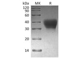 Recombinant Cynomolgus PD-1/CD279/PDCD1 Protein (His Tag)