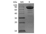 Recombinant Cynomolgus PD-L1/B7-H1/CD274 Protein (Fc Tag)