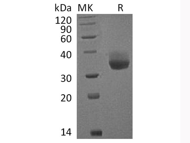Recombinant Cynomolgus PD-L1/B7-H1/CD274 Protein (His Tag)