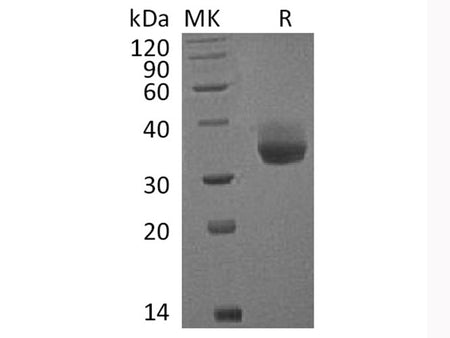 Recombinant Cynomolgus PD-L1/B7-H1/CD274 Protein (His Tag)