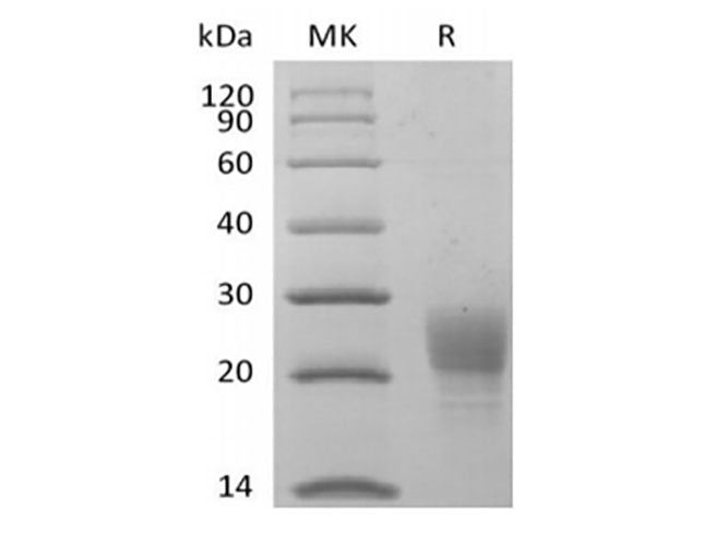Recombinant Cynomolgus PVRIG (C-6His)