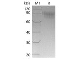 Recombinant Cynomolgus SIGLEC5/CD170 Protein (His Tag)