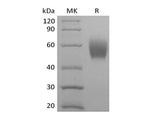 Recombinant Cynomolgus Signal-Regulatory Protein alpha-1/SIRPA/CD172a (C-6His)
