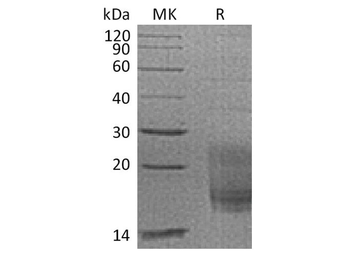 Recombinant Cynomolgus TIGIT/VSIG9/VSTM3 Protein (His Tag)
