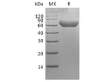 Recombinant Cynomolgus TIM-3/HAVCR2 Protein (Fc Tag)