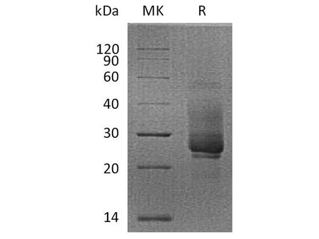 Recombinant Cynomolgus TIM-3/HAVCR2 Protein (His Tag)