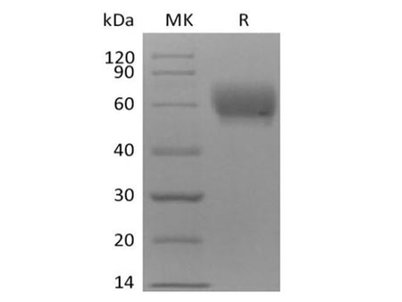 Recombinant Cynomolgus TPBG/5T4 (C-6His)