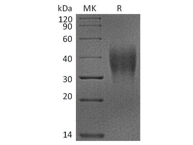 Recombinant Cynomolgus VSIR Protein (His Tag)