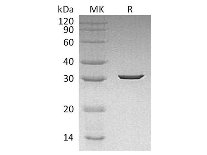 Recombinant Dechloromonas aromatica Chlorite Dismutase Protein (His Tag)