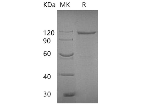 Recombinant E.coli Beta-galactosidase Protein(M443L, C500S) (Fc Tag)