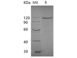 Recombinant E.coli Beta-galactosidase Protein(M443L, C500S) (Fc Tag)