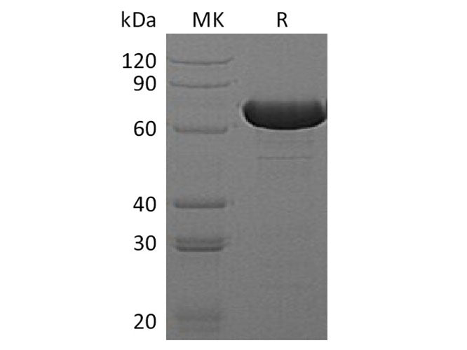 Recombinant E.coli Beta-Glucuronidase/Uida/Beta-Gus Protein (His Tag)
