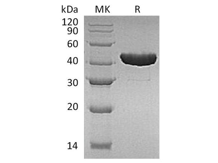 Recombinant E.coli Tryptophan Synthase β Chain/Trp B Protein (His Tag)