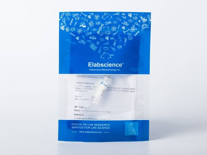 Recombinant EBOV (Subtype Sudan, strain Gulu) Glycoprotein / GP Protein (aa:Met1-Asn637, His Tag)