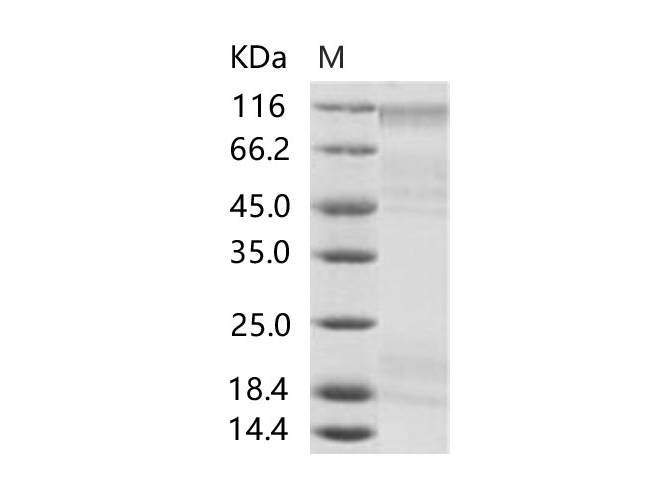 Recombinant EBOV (Subtype Sudan, strain Gulu) Glycoprotein / GP Protei ...