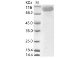 Recombinant HCoV-229E S1 Protein (His Tag)