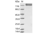 Recombinant HCoV-229E S1+S2 Protein (ECD, His Tag)