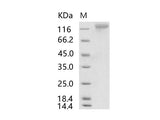 Recombinant HCoV-HKU1 (Isolate N1) S1 Protein (His Tag)