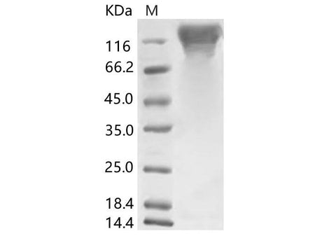 Recombinant HCoV-HKU1 (Isolate N5) S1 Protein (His Tag)