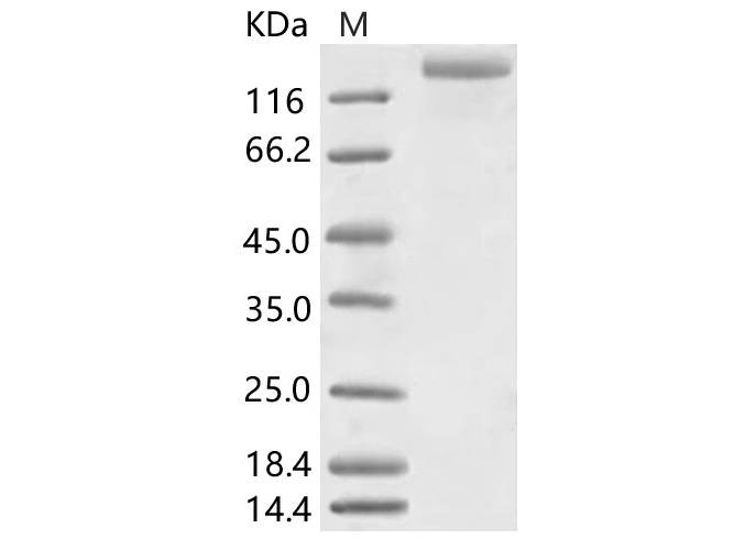 Recombinant HCoV-NL63 S1+S2 Protein (ECD, His Tag)