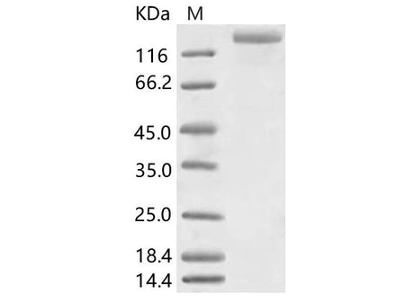 Recombinant HCoV-NL63 S1+S2 Protein (ECD, His Tag)