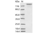Recombinant HCoV-NL63 S1+S2 Protein (ECD, His Tag)
