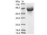 Recombinant HCoV-OC43 Hemagglutinin esterase Protein (His Tag)